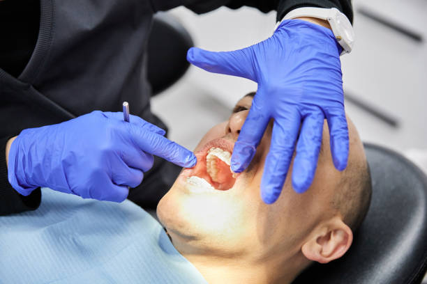 Best Chipped Tooth Repair Near Me  in Elwood, IL