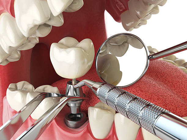 Best Broken Tooth Emergency  in Elwood, IL