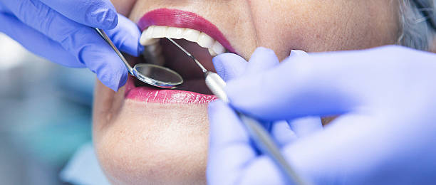 Best Emergency Dental Clinic in IL